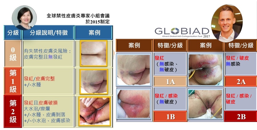 失禁性皮膚炎常見分級